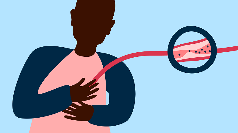 心臟科常見檢查項目9個，幫助您看到心血管一清二楚